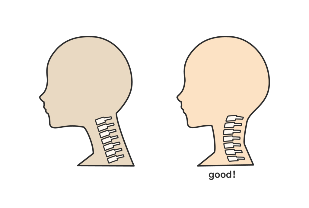 頸椎が正常とストレートネックの比較